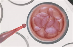 怀孕期间贫血对胎儿有什么影响